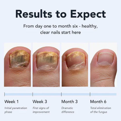 Evina™ Anti-fungal Pen