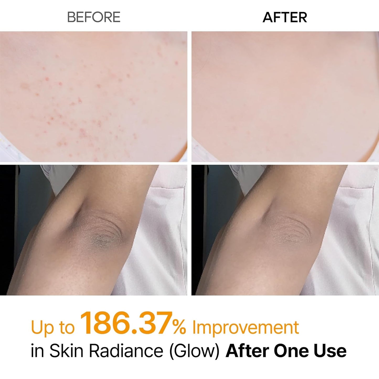 Peel Shot Keratin Kojic Spray
