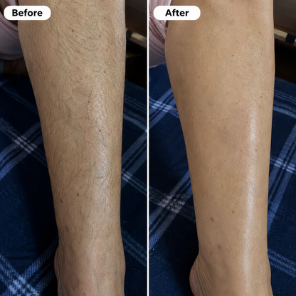 Evina™ Hair Removal Cream