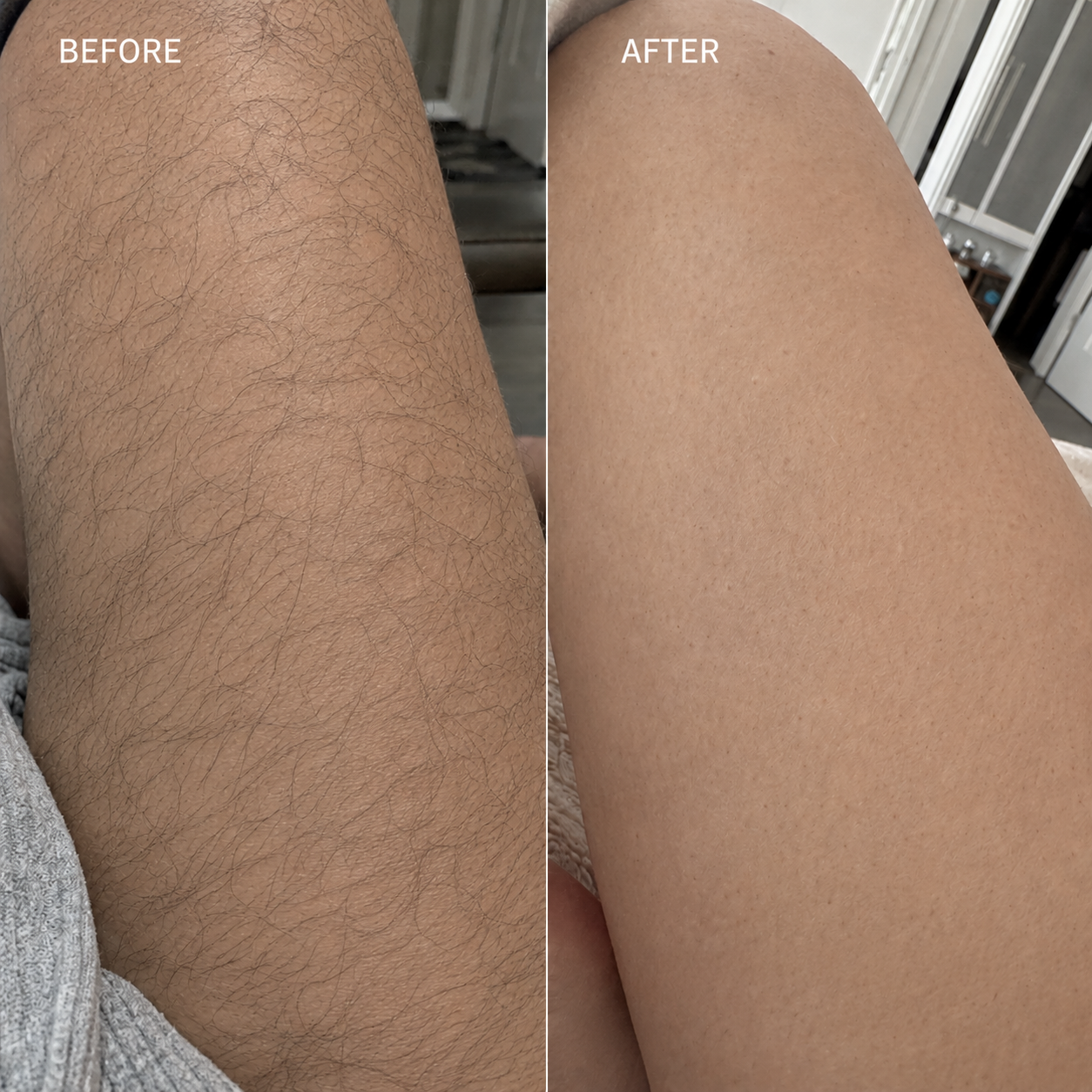 Evina™ Hair Removal Cream