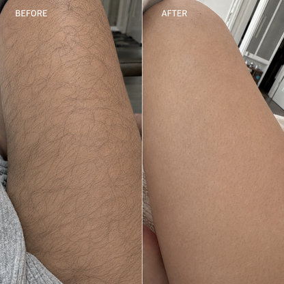 Evina™ Hair Removal Cream