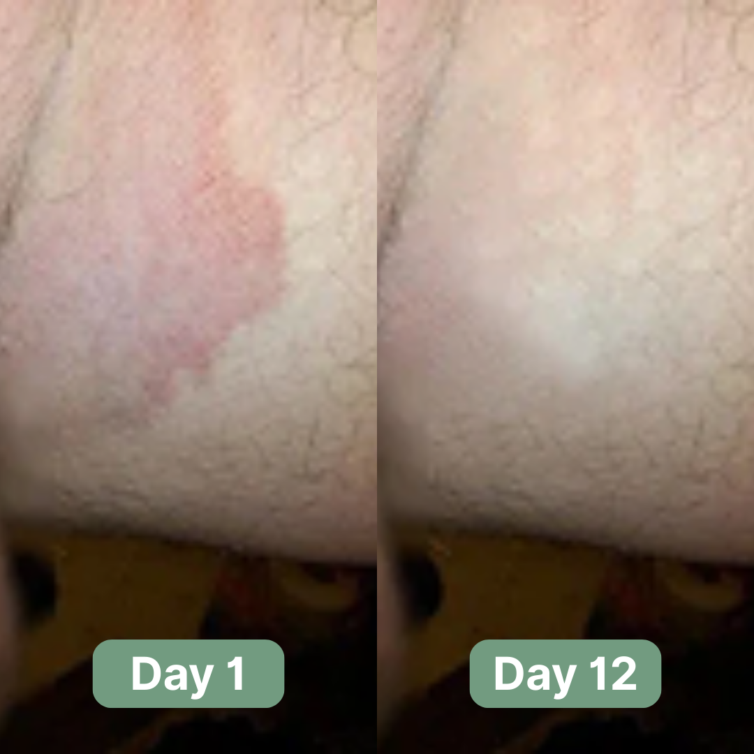 Evina™ Antifungal Soap