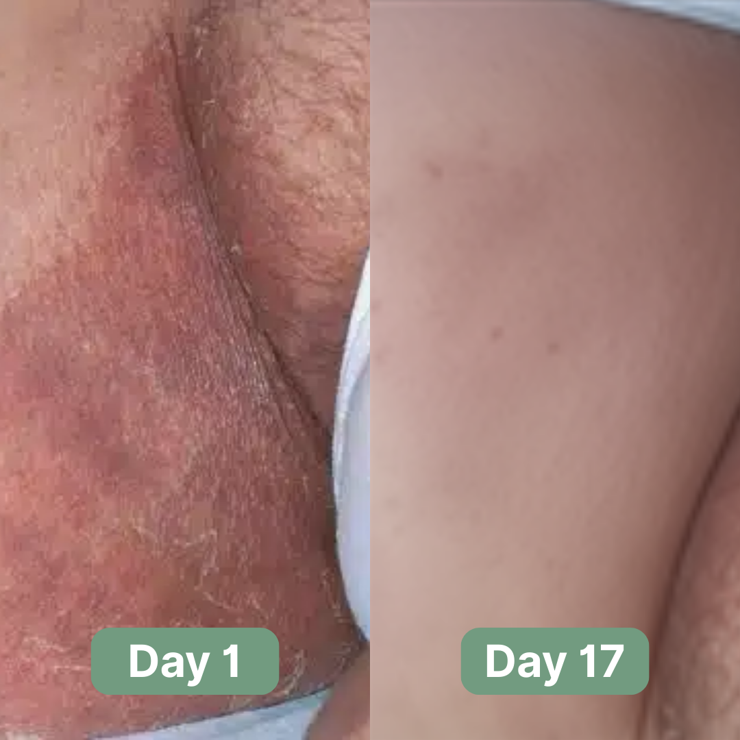 Evina™ Antifungal Soap